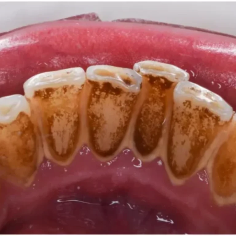 best dental scaling clinic in Eluru