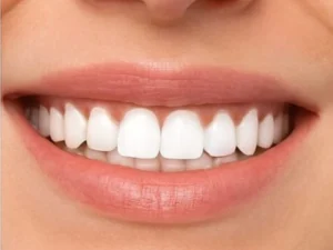 best smile design services in eluru