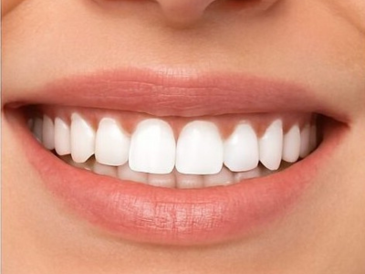 best smile design services in eluru
