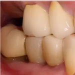 top Dental implants in eluru