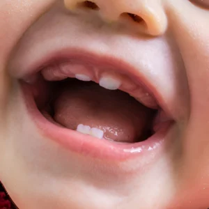 best kids dental clinic in eluru