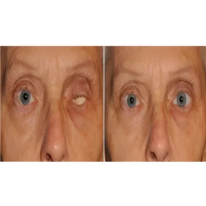 ocular treatment dentist in eluru