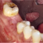 best single implant center