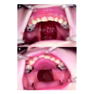 speech aid treatment in eluru